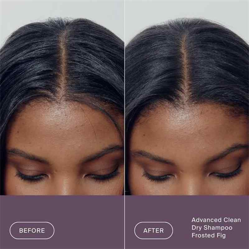 Before and after comparison of a person's hairline and part line showing a frosted figure effect, with text at the bottom reading 'Advanced Clean Dry Shampoo Frosted Fig'.