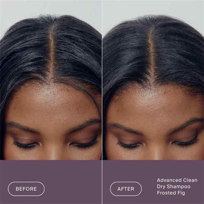 Before and after comparison of a person's hairline and part line showing a frosted figure effect, with text at the bottom reading 'Advanced Clean Dry Shampoo Frosted Fig'.
