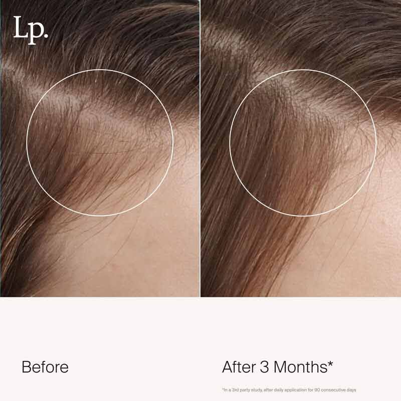 Living Proof Scalp Care Revitalizing Treatment | night-time treatment | ally | environmental stressors | hair grows fuller | thicker | healthier | root | damaged strands | vibrant hair.