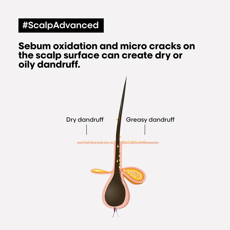 L'Oréal Professionnel Serié Expert Scalp Advanced Anti-Dandruff Dermo-Clarifier Shampoo