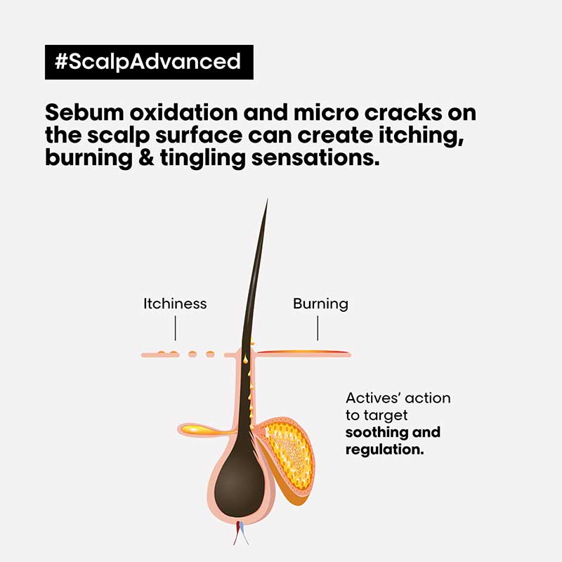 L'Oréal Professionnel Serié Expert Scalp Advanced Anti-Discomfort Hair Treatment | Hair mask | scalp advance | soothing scalp treatment | L'oreal Professional