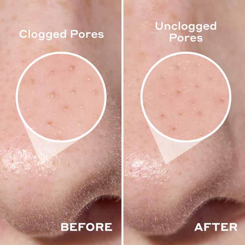 Mario Badescu 2-in-1 Deep Cleansing Pore Strips Before & After