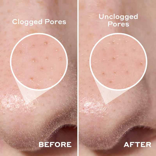 Mario Badescu 2-in-1 Deep Cleansing Pore Strips Before & After