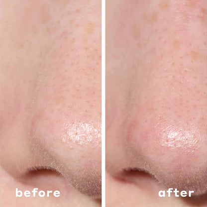 Mario Badescu 2-in-1 Deep Cleansing Pore Strip Before & After