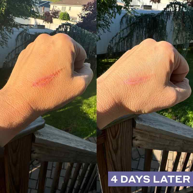 Mario Badescu Repairing Facial Spray With Hypochlorous Acid 118ml Before & After