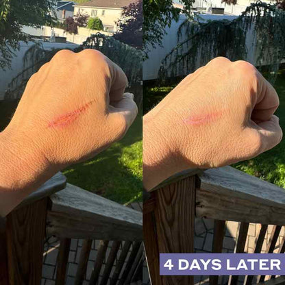 Mario Badescu Repairing Facial Spray With Hypochlorous Acid 118ml Before & After