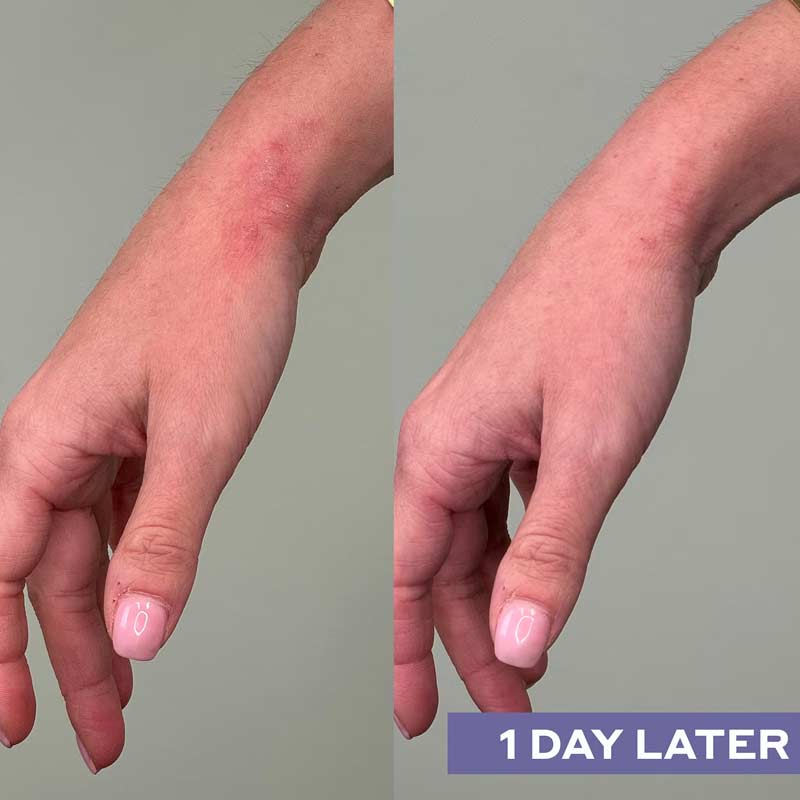 Mario Badescu Repairing Facial Spray With Hypochlorous Acid Before & After