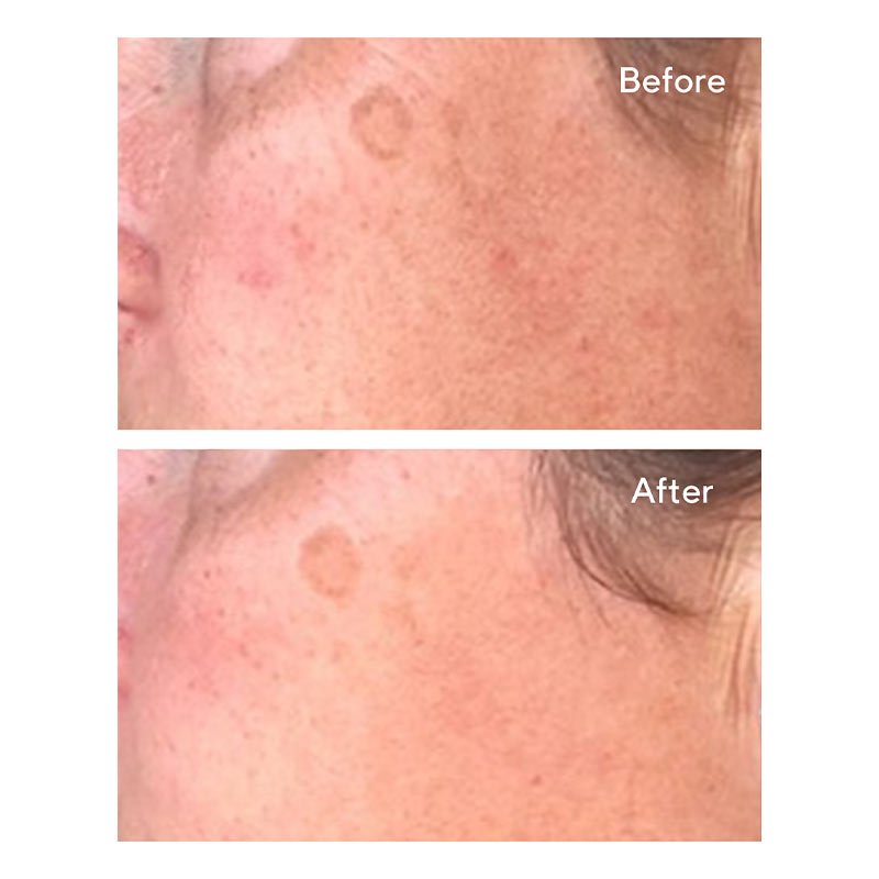 Murad Correct & Protect Serum SPF 45 | PA++++