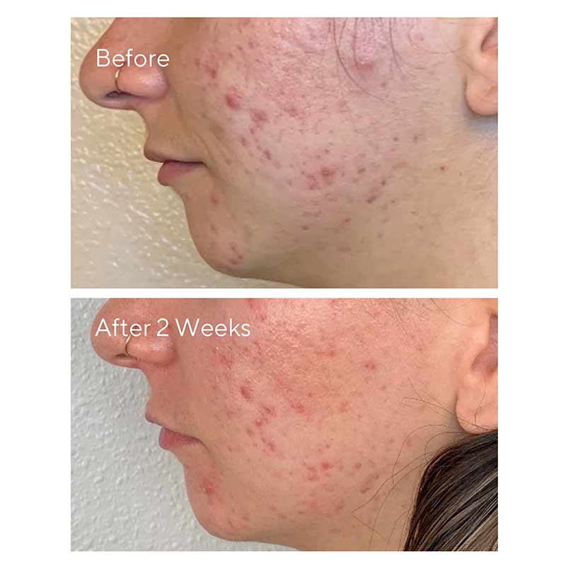 Murad Daily Clarifying Peel