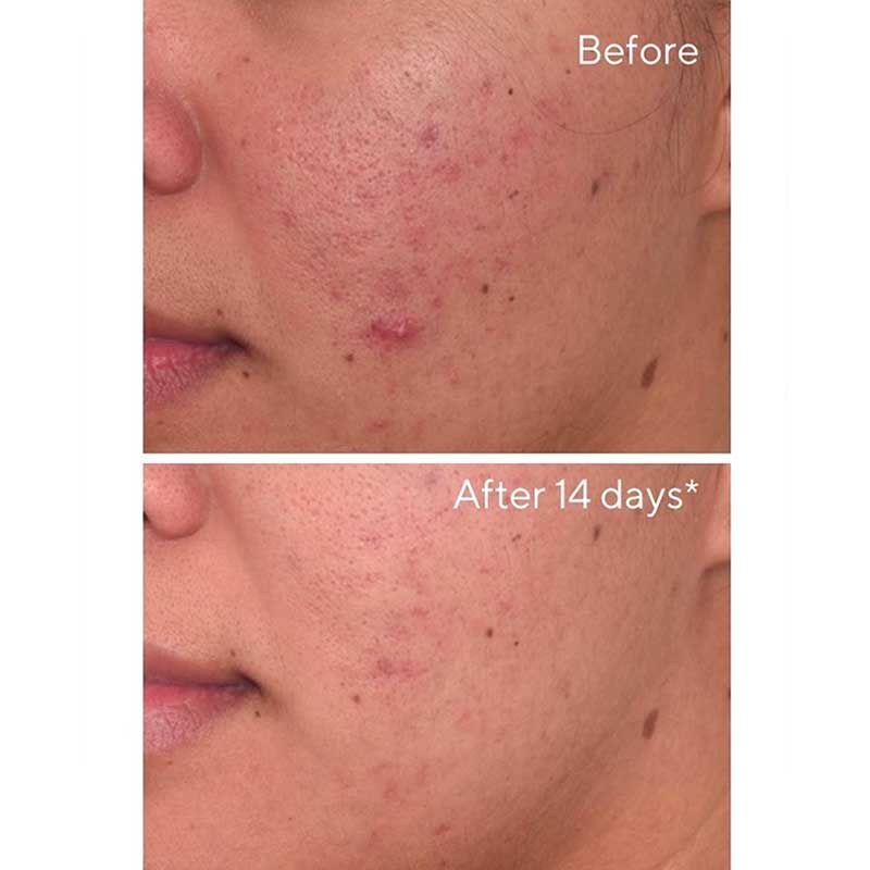 Murad | Rapid | Dark Spot | Correcting Serum | glycolic acid | face serum | removes dead skin cells | promotes cell turnover | brighter | even | complexion | natural radiance | penetration