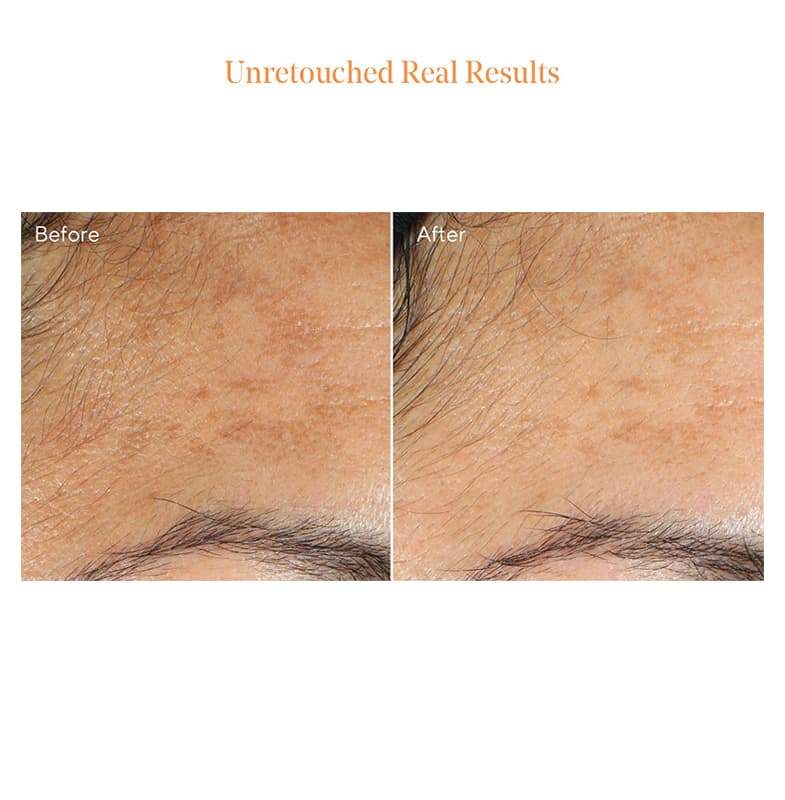 Murad Environmental Shield Vita-C Glycolic Brightening Serum | Vitamin C Serum