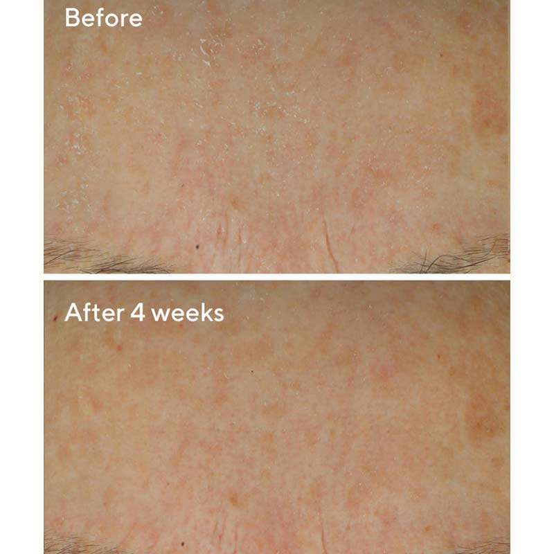 Murad Daily Defense Cream | results | before | after | dryness | visibly reduced | healthy | comfortable | hydrated | skin 