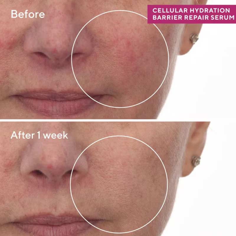 Murad Hydration Cellular Hydration Repair Serum Results Before And After