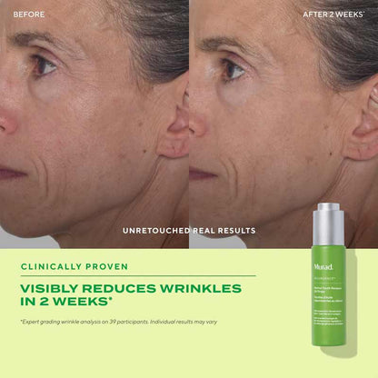 Murad Resurgence Retinol Youth Renewal Oil Drops Before & After