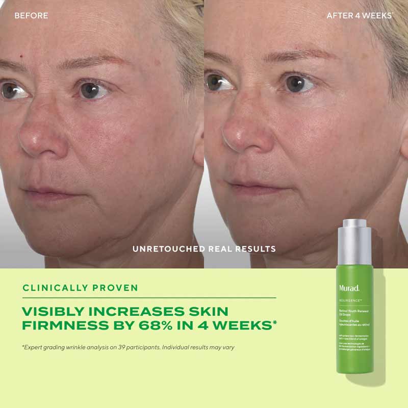 Murad Resurgence Retinol Youth Renewal Oil Drops Before and After