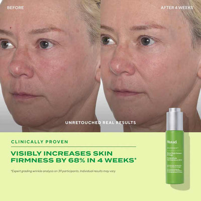 Murad Resurgence Retinol Youth Renewal Oil Drops Before and After
