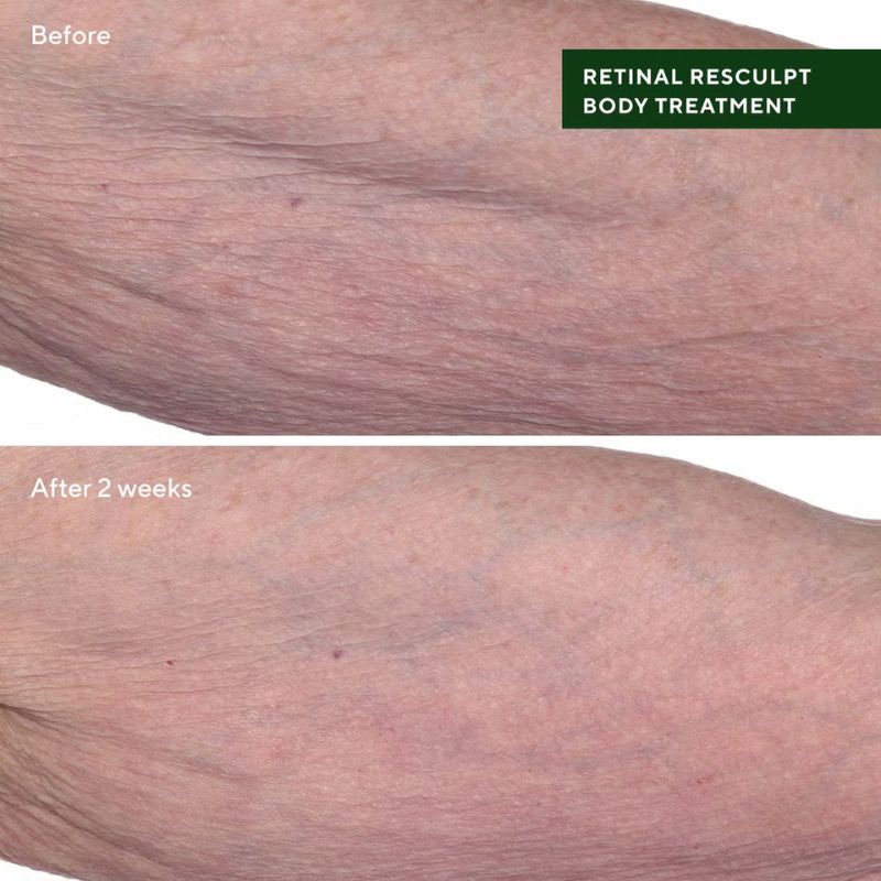 Murad Retinal ReSculpt Body Treatment Before & After
