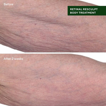 Murad Retinal ReSculpt Body Treatment Before & After