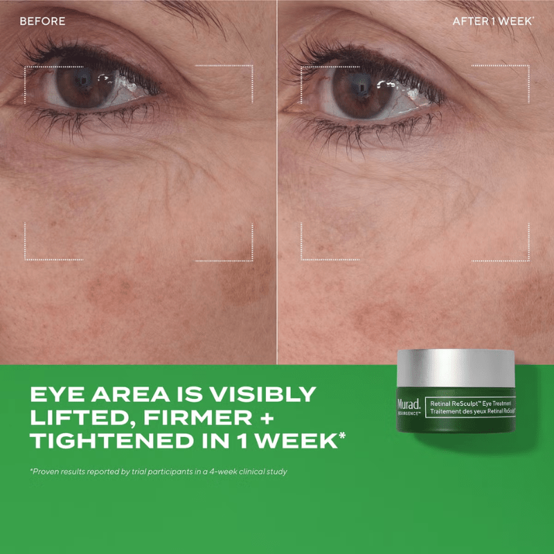 Murad Retinal ReSculpt Eye Treatment results on eye bags