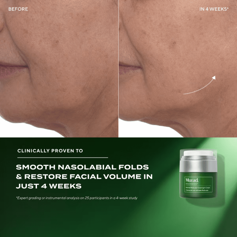 Murad Retinal ReSculpt Overnight Cream results Before And After