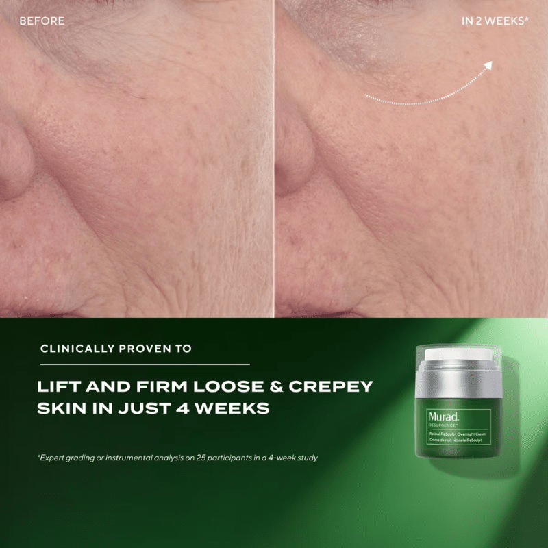 Murad Retinal ReSculpt Overnight Cream results before and after image