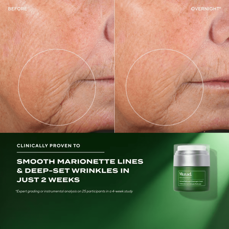 Murad Retinal ReSculpt Overnight Cream results on marionette lines