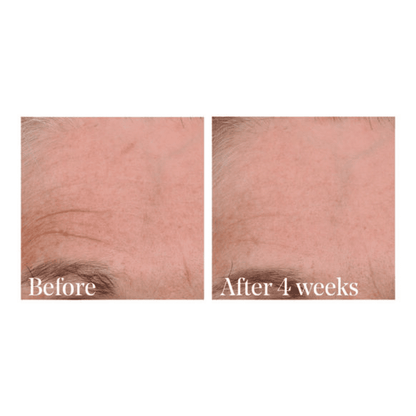 Murad Retinal ReSculpt Overnight Treatment