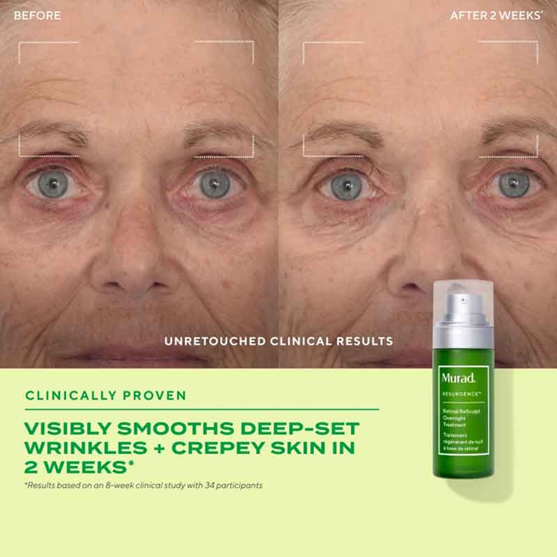 Murad Sleep Tight Retinal Gift Set Results