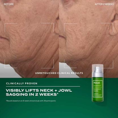 Murad The Retinal ReSculptors Gift Set Before and After