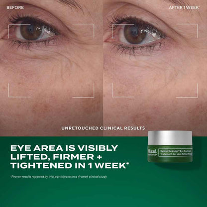 Murad The Retinal ReSculptors Gift Set Before and after