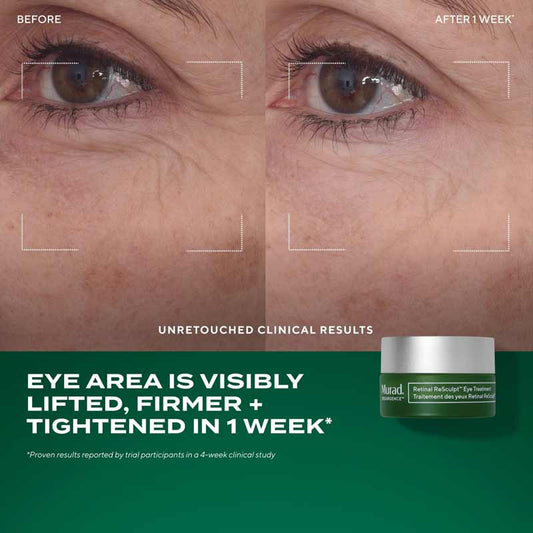 Murad The Retinal ReSculptors Gift Set Before and after