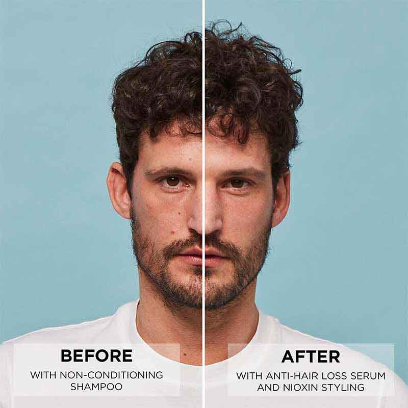 Nioxin | Anti Hair Loss | Serum | Intensive | Treatment | caffeine | niacinamide | scalp | hair growth 