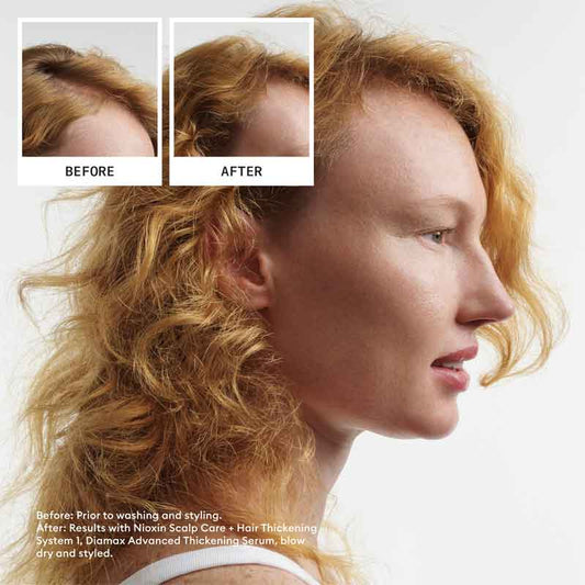 Nioxin System 1 Three Part Trial Kit, scalp care haircare, hair thickening treatment,