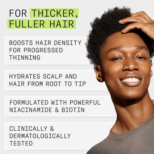 Nioxin System 2 Scalp & Hair Treatment Benefits Infograhpic
