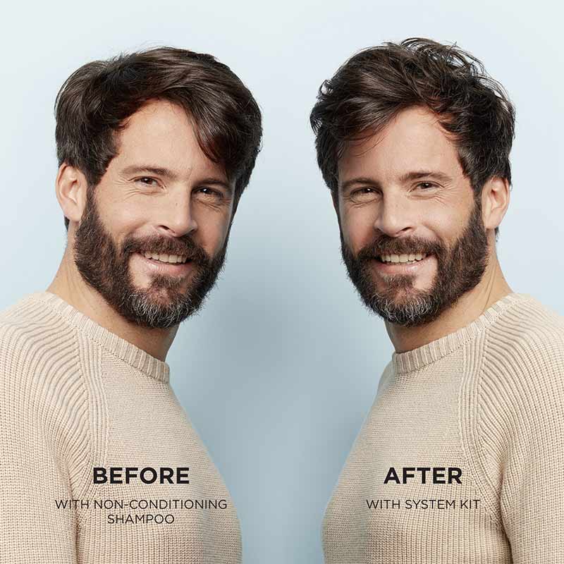Nioxin | System 2 | Three Part Loyalty Kit | ultimate | thickening products | natural hair | progressed thinning | set | treatments | value set | comprehensive | three-step | full-sized | beautifully thick | fuller-looking hair 