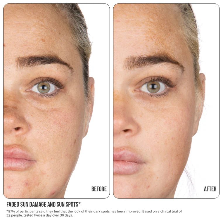 Nip & fab, for sun damage, for sun spots