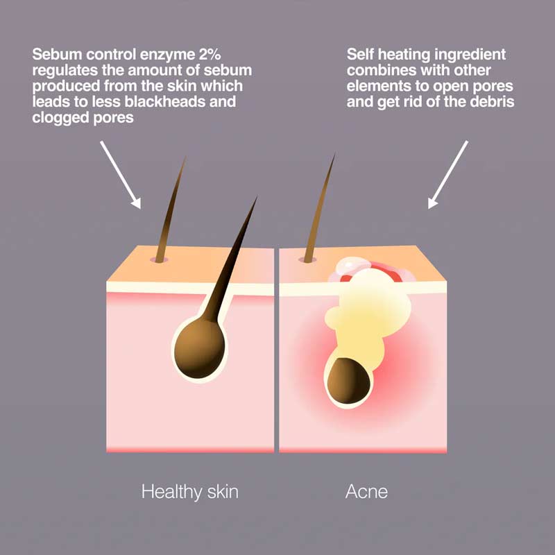 Nip + Fab Salicylic Fix Blackhead Steam Mask 8%