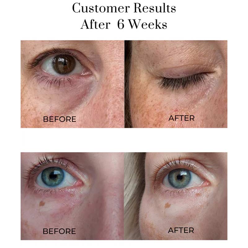 Oskia London | Eye Wonder Nutri-Active Eye Serum | Puffy Eyes | Dark Circles | Radiant Undereye