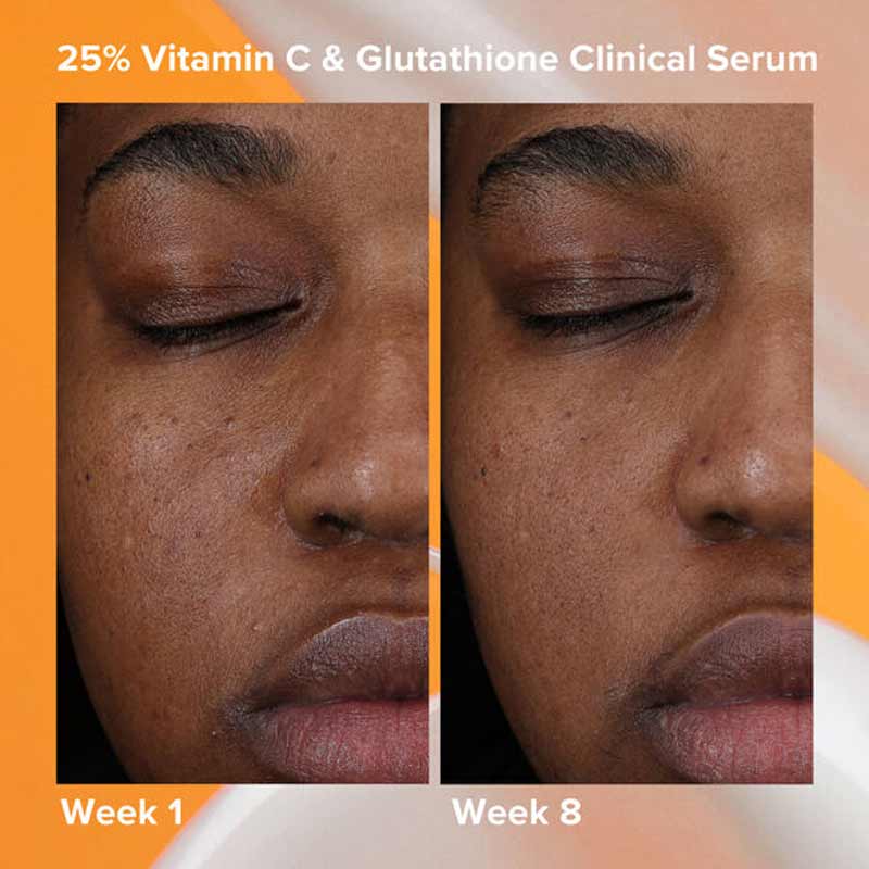 Paula's Choice 25% Vitamin C + Glutathione Clinical Serum Cloud 10 Beauty Paula's Choice 25% Vitamin C + Glutathione Clinical Serum Cloud 10 Beauty