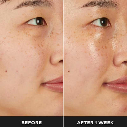 Paula's Choice 7% Ectoin + Hyaluronic Acid Milky Hydrating Serum Before & After 1 week