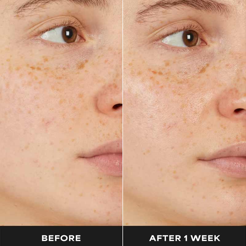 Paula's Choice 7% Ectoin + Hyaluronic Acid Milky Hydrating Serum Before & After 1 week