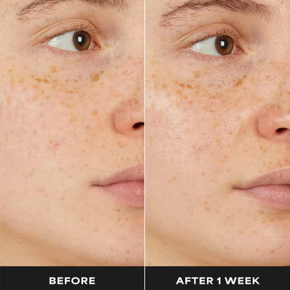 Paula's Choice 7% Ectoin + Hyaluronic Acid Milky Hydrating Serum Before & After 1 week
