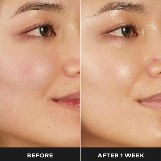 Paula's Choice 7% Ectoin + Hyaluronic Acid Milky Hydrating Serum Before & After 1 week