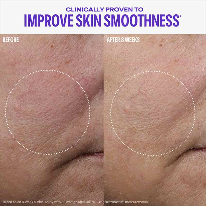 Paula's Choice Cellular Youth Longevity Serum Before & After