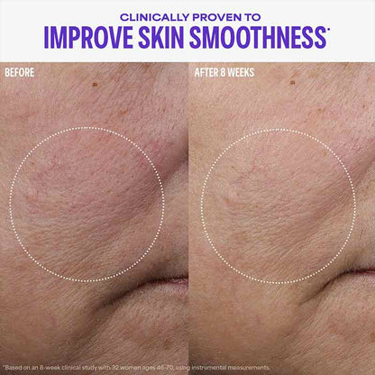 Paula's Choice Cellular Youth Longevity Serum Before & After