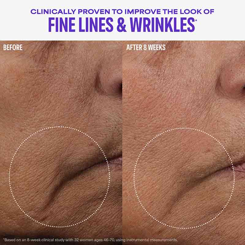 Paula's Choice Cellular Youth Longevity Serum Before & After