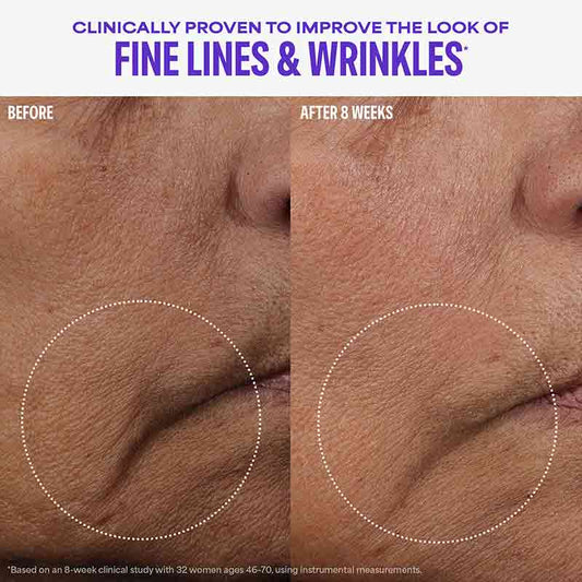 Paula's Choice Cellular Youth Longevity Serum Before & After