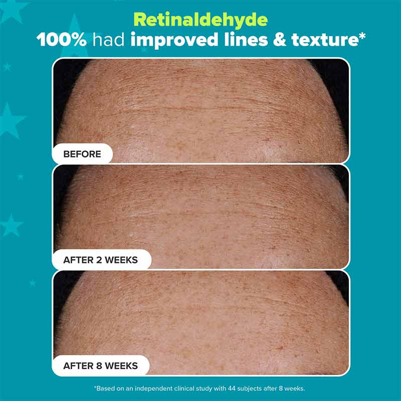 Paula's Choice Dual Retinaldehyde Before and after pictures