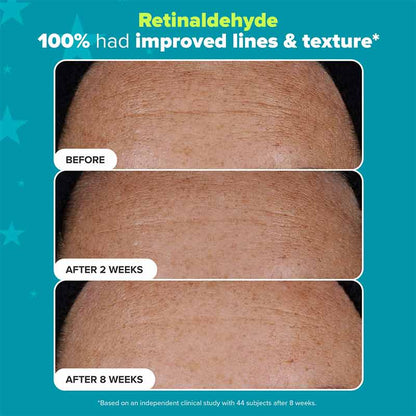 Paula's Choice Dual Retinaldehyde Before and after pictures