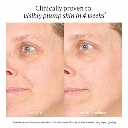 Paula's Choice Pro-Collagen Peptide Plumping Intensive Moisturiser Before & After